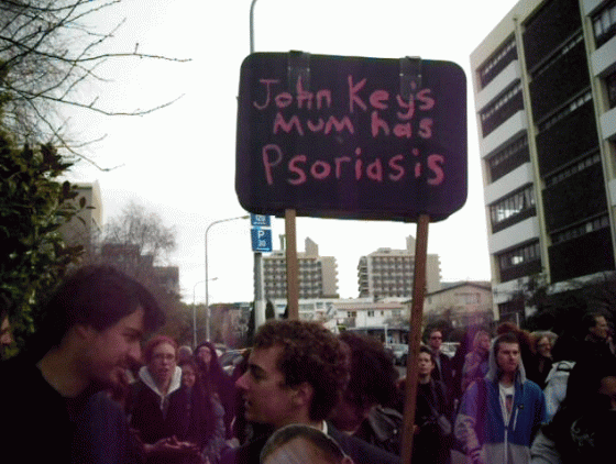 psoriasis